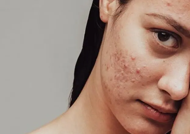 Rosto com textura de pele em tratamento dermatológico